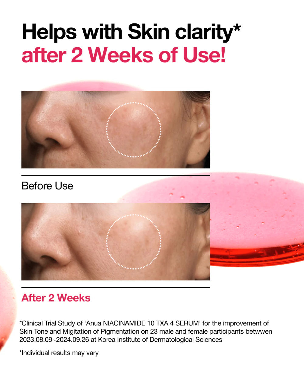 Anua Niacinamide 10% + TXA 4% Serum (30ml)
