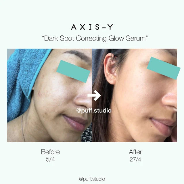 AXIS-Y Dark Spot Correcting Glow Serum (50ml)
