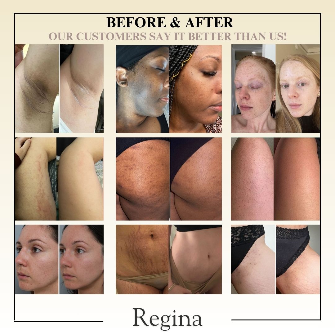 Pure Exfoliating Gel