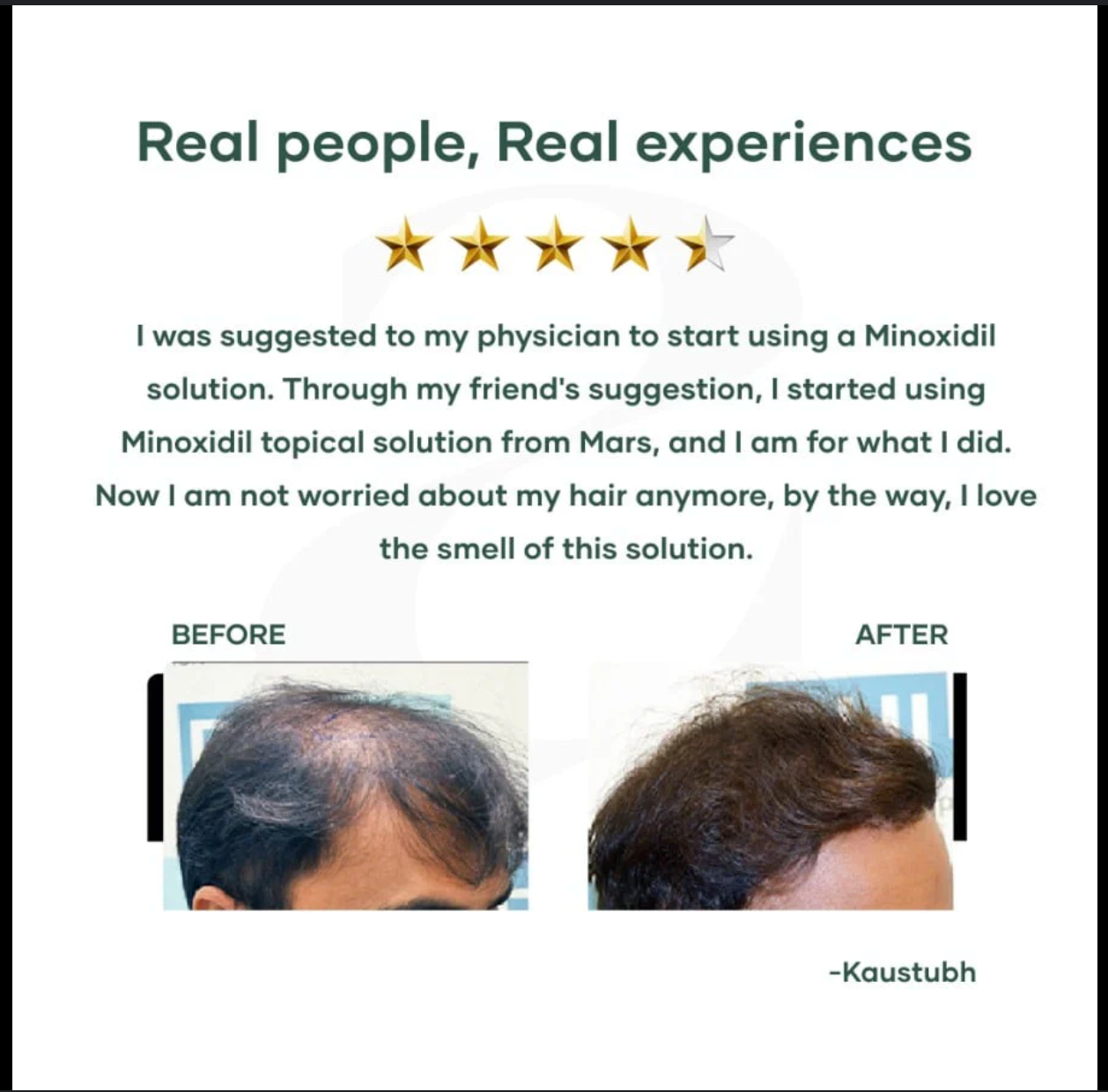 Minoxidil Solution High Strength