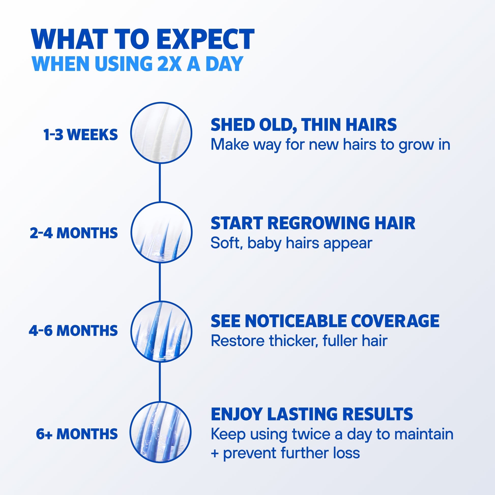 Minoxidil Solution High Strength