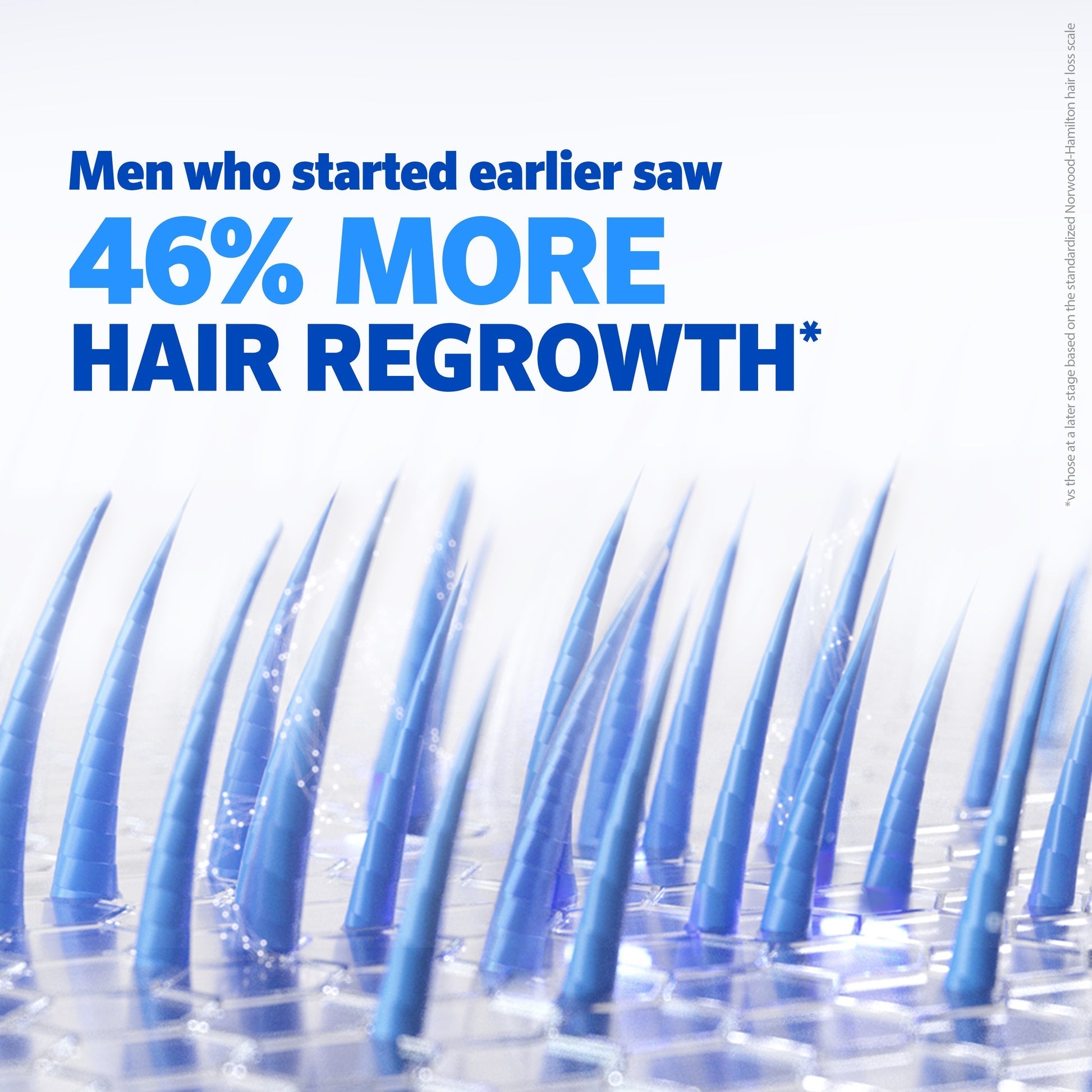 Minoxidil Solution High Strength
