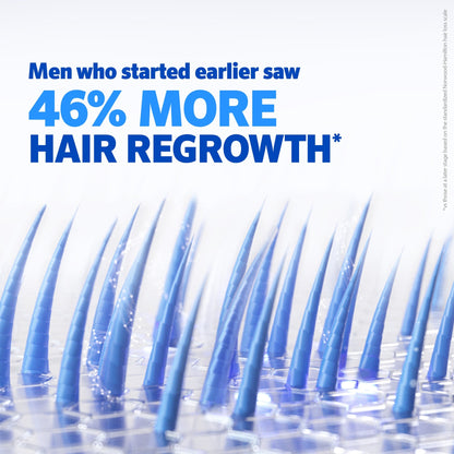 Minoxidil Solution High Strength